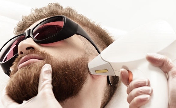 تحديد اللحيه بالليزر